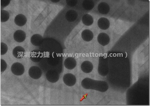 BGA因?yàn)楹笁|變小，造成錫膏過(guò)多而最終形成焊接短路的結(jié)果。